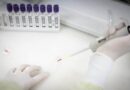 São Paulo Monitora Caso Suspeito de Ebola com Vigilância Intensificada