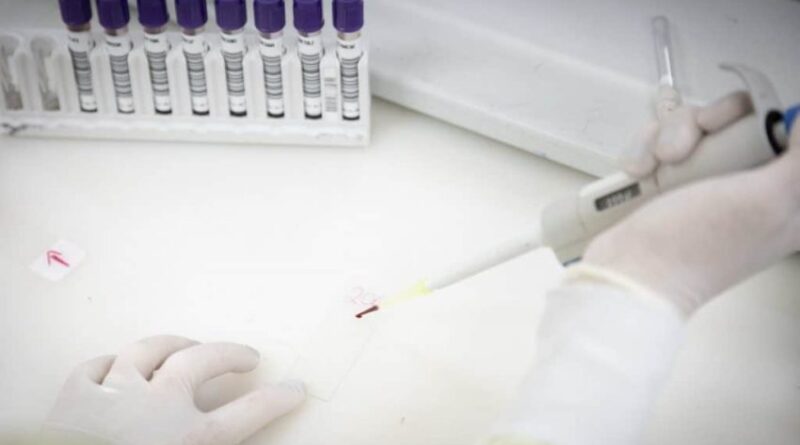 São Paulo Monitora Caso Suspeito de Ebola com Vigilância Intensificada